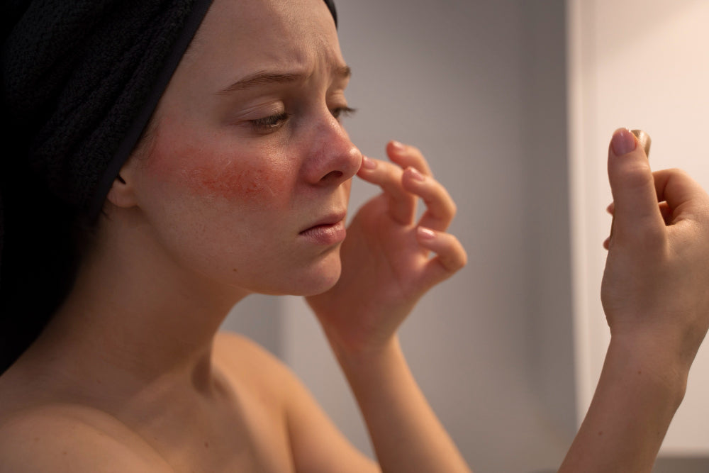 Razumevanje TSW (Topical Steroid Withdrawal): Naučna Perspektiva